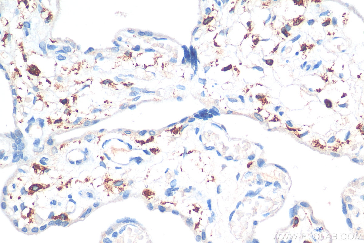 Immunohistochemistry (IHC) staining of human placenta tissue using CD163 Polyclonal antibody (16646-1-AP)