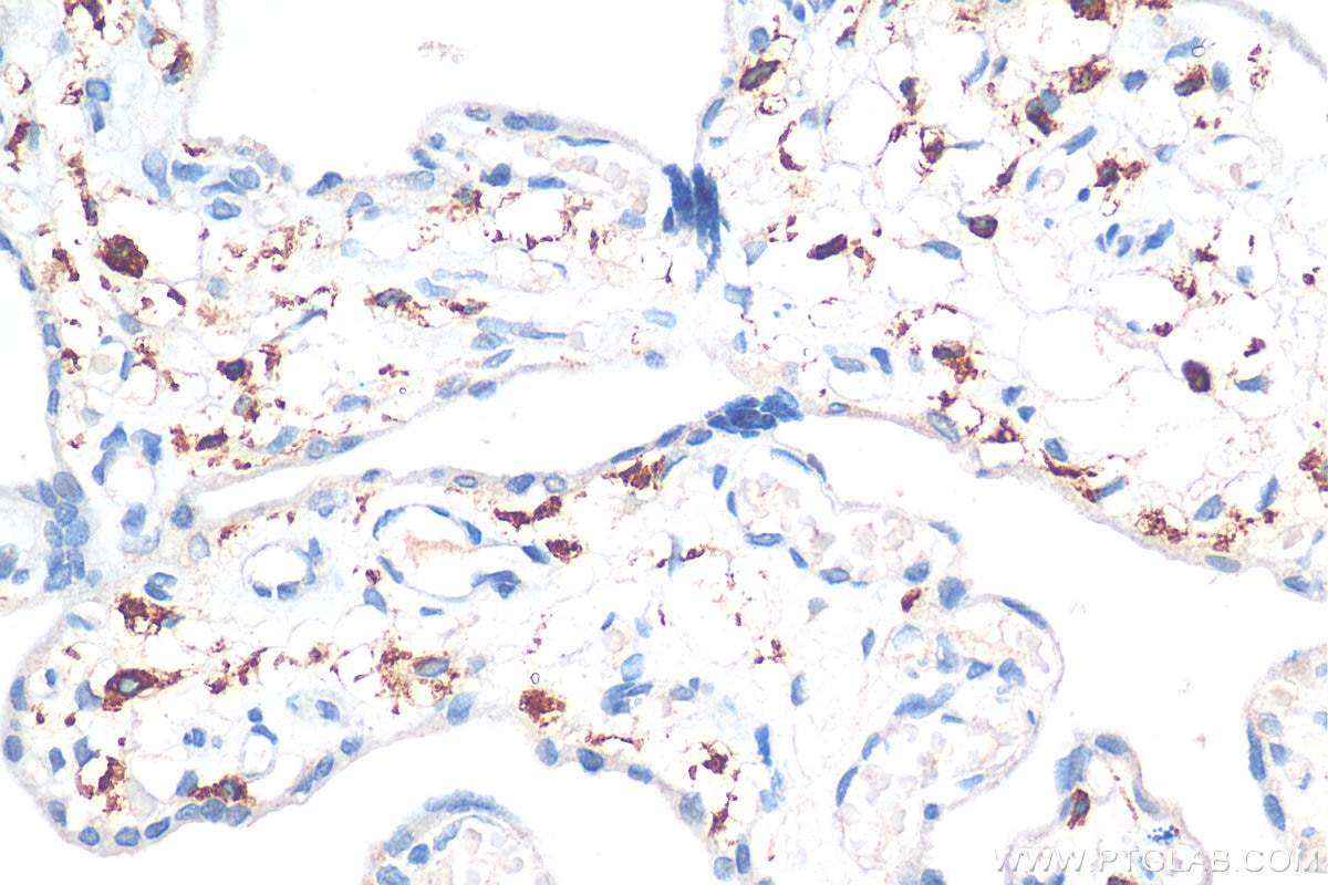 IHC staining of human placenta using 16646-1-AP