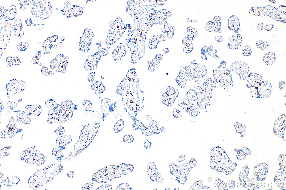 Immunohistochemistry (IHC) staining of human placenta tissue using CD163 Polyclonal antibody (16646-1-AP)