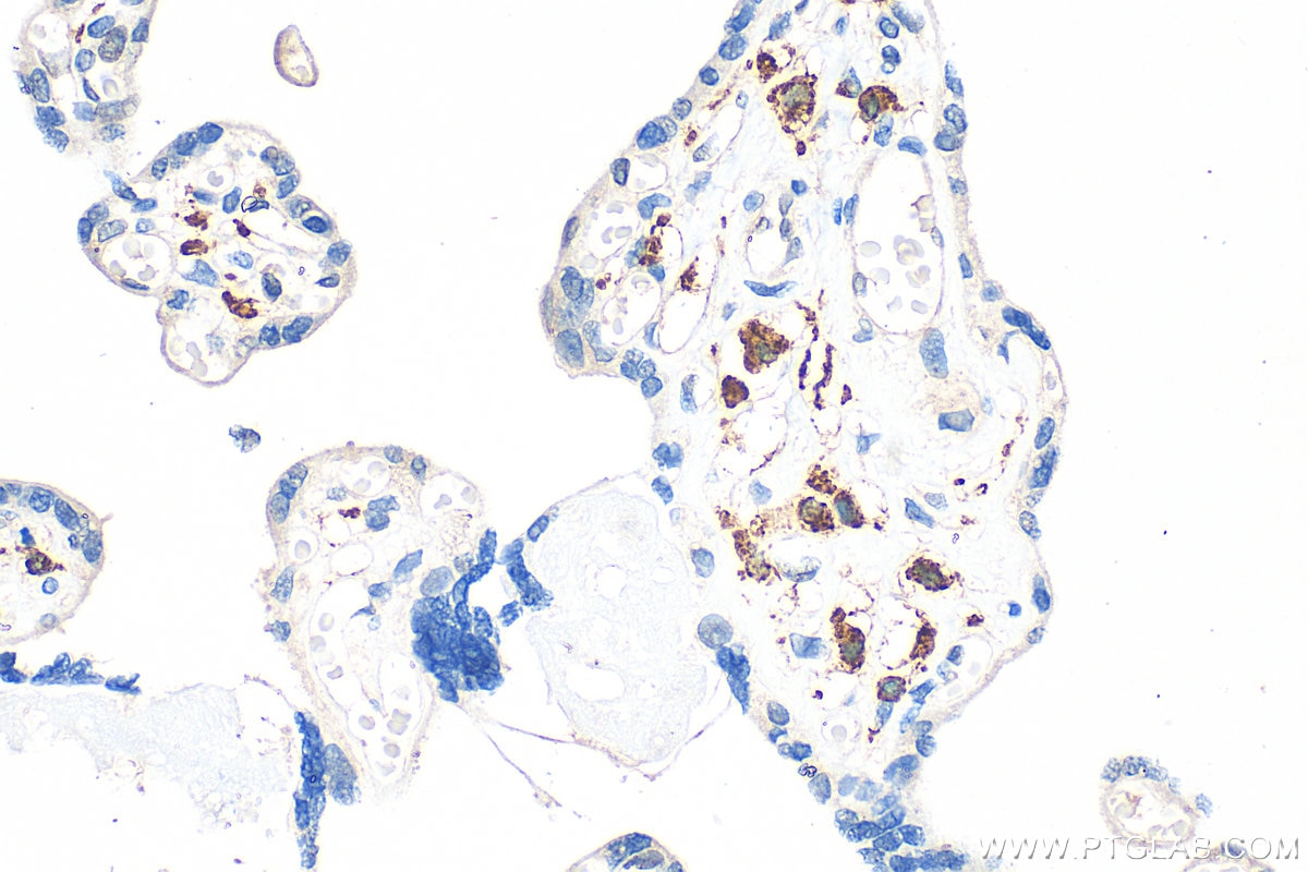 Immunohistochemistry (IHC) staining of human placenta tissue using CD163 Polyclonal antibody (16646-1-AP)