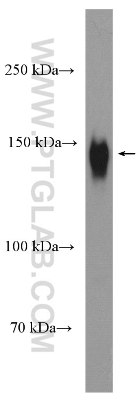 Western Blot (WB) analysis of human placenta tissue using CD163 Polyclonal antibody (16646-1-AP)