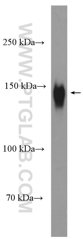 WB analysis of human placenta using 16646-1-AP