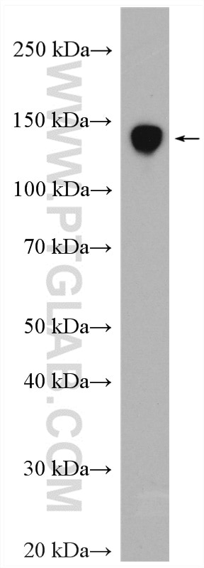 WB analysis of pig spleen using 16646-1-AP