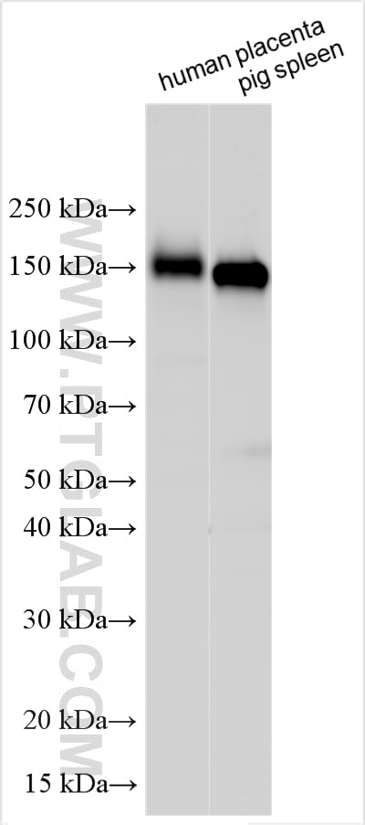 Western Blot (WB) analysis of various lysates using CD163 Polyclonal antibody (16646-1-AP)