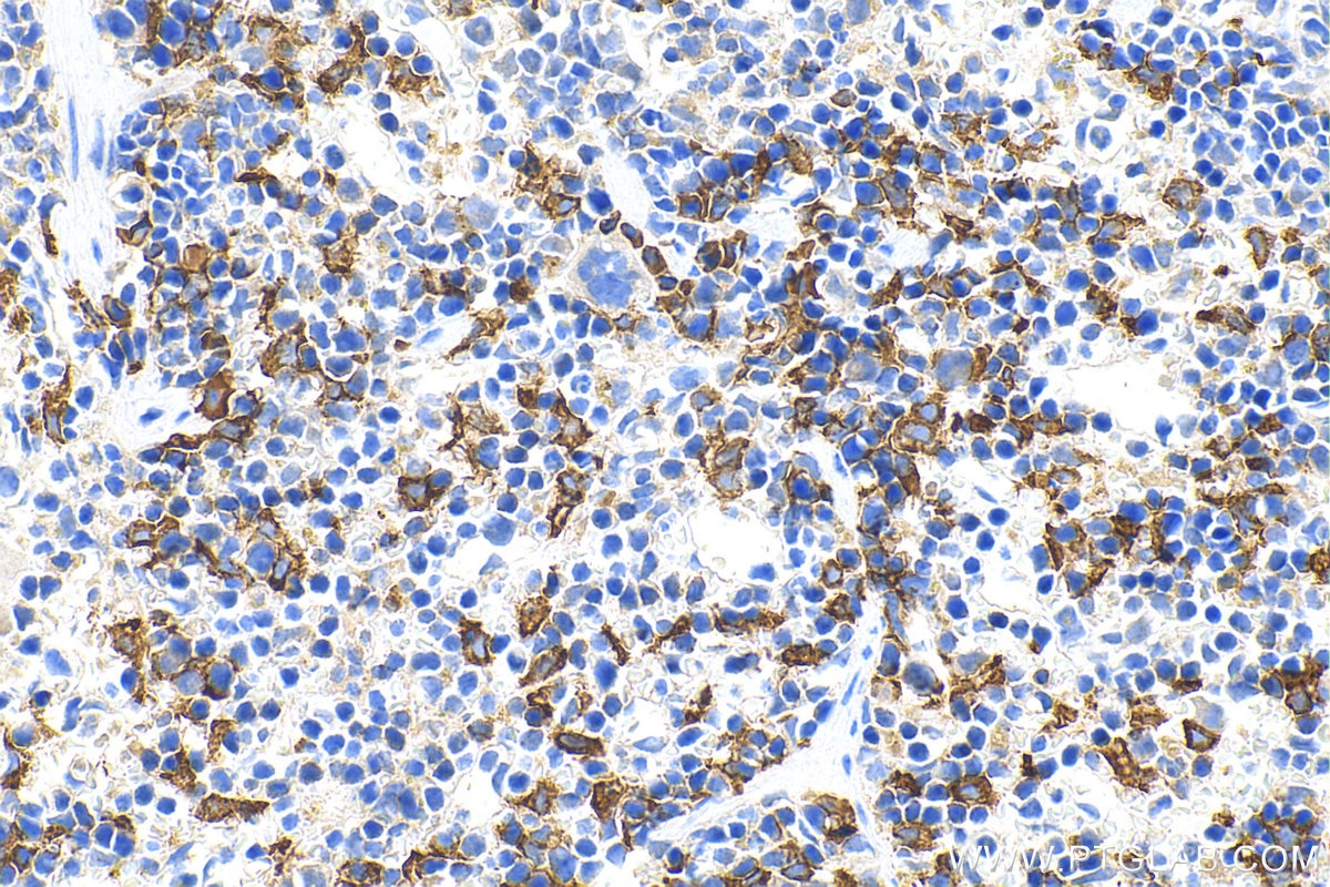 Immunohistochemistry (IHC) staining of mouse spleen tissue using CD163 Polyclonal antibody (31024-1-AP)