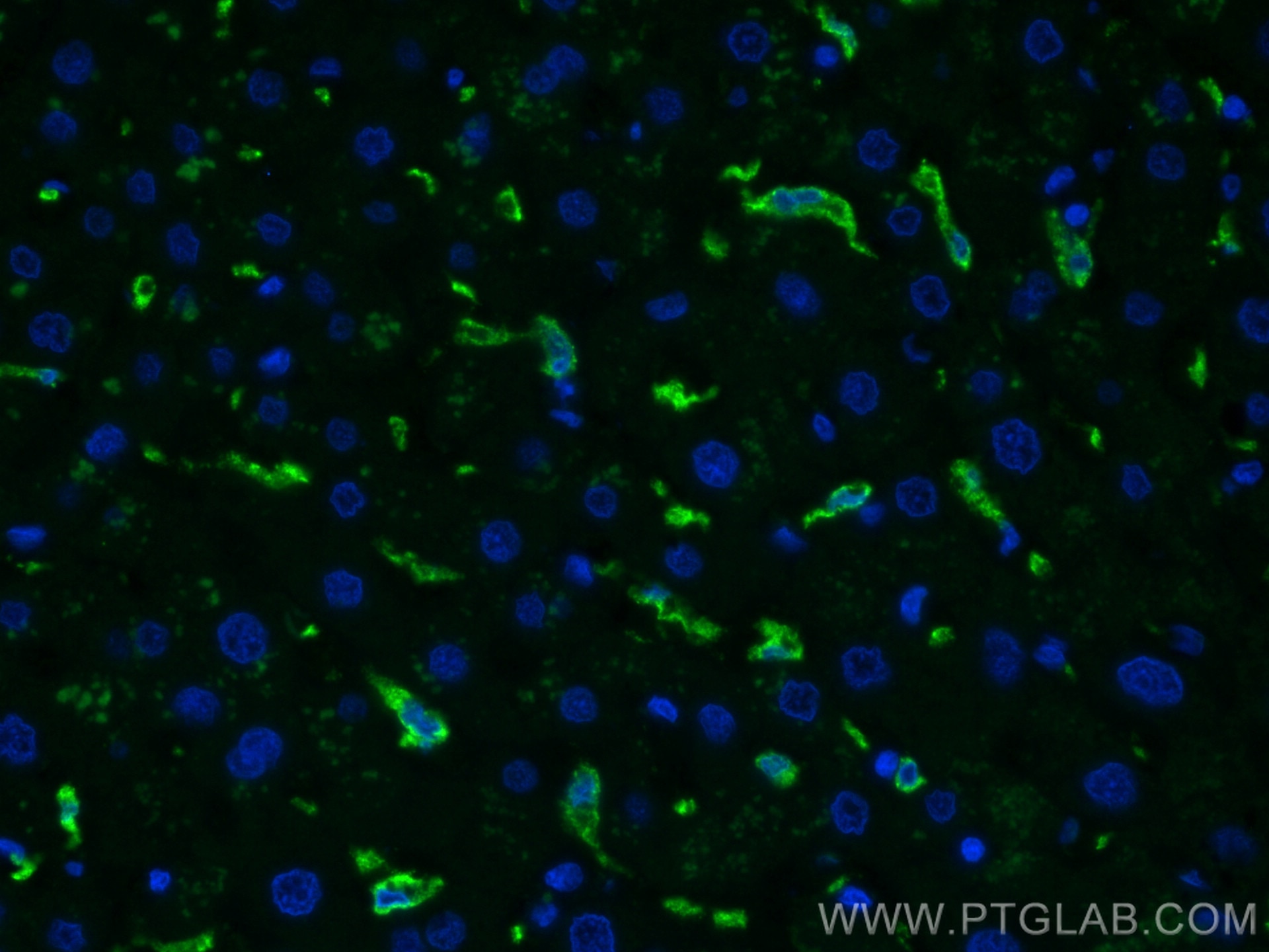 Immunofluorescence (IF) / fluorescent staining of human liver tissue using CD163 Monoclonal antibody (68218-1-Ig)