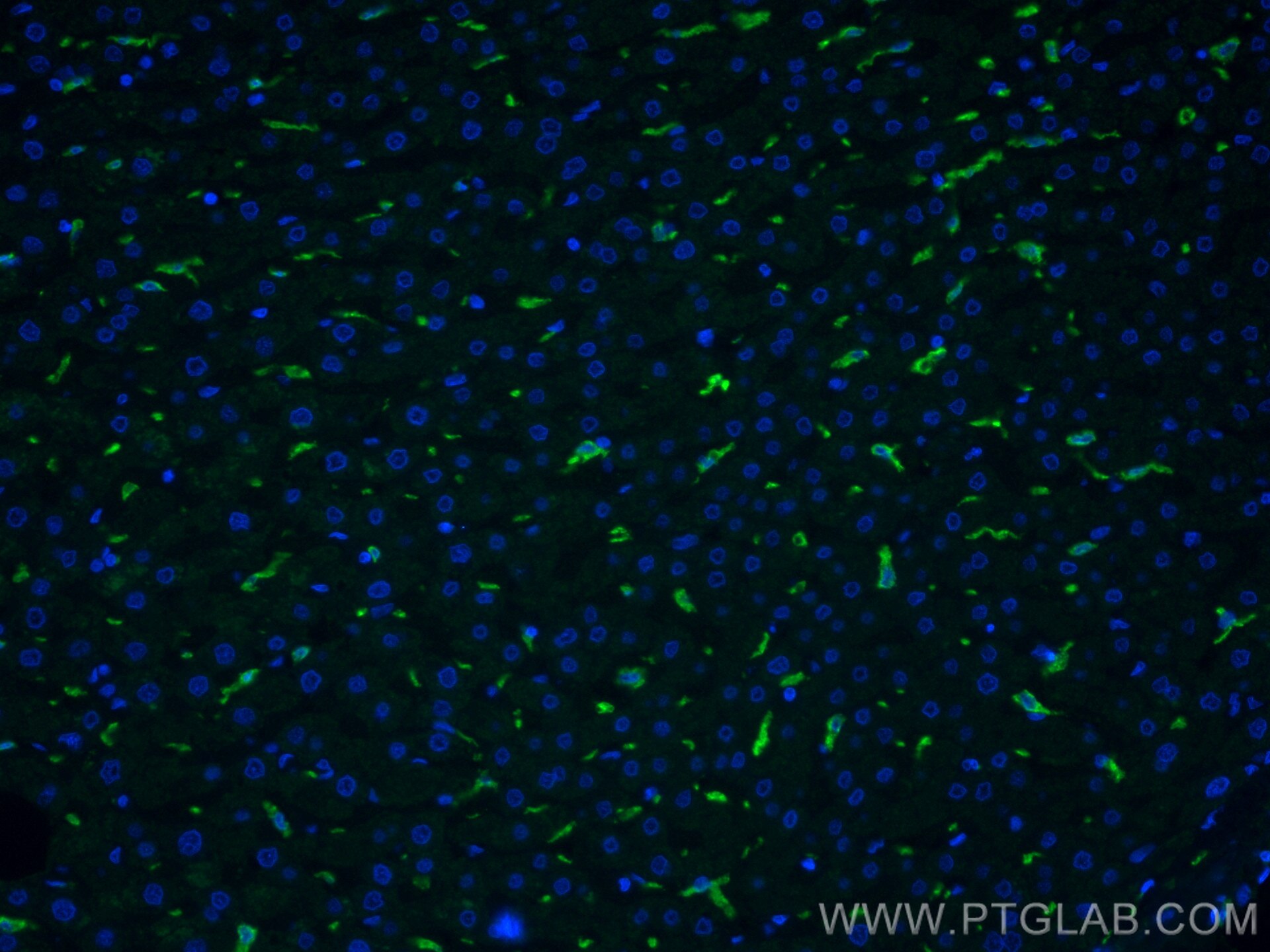 Immunofluorescence (IF) / fluorescent staining of human liver tissue using CD163 Monoclonal antibody (68218-1-Ig)