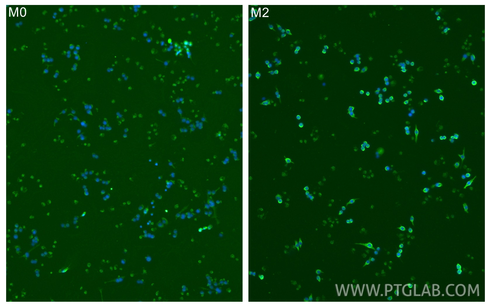 Immunofluorescence (IF) / fluorescent staining of RAW 264.7 cells using CD163 Monoclonal antibody (68218-1-Ig)
