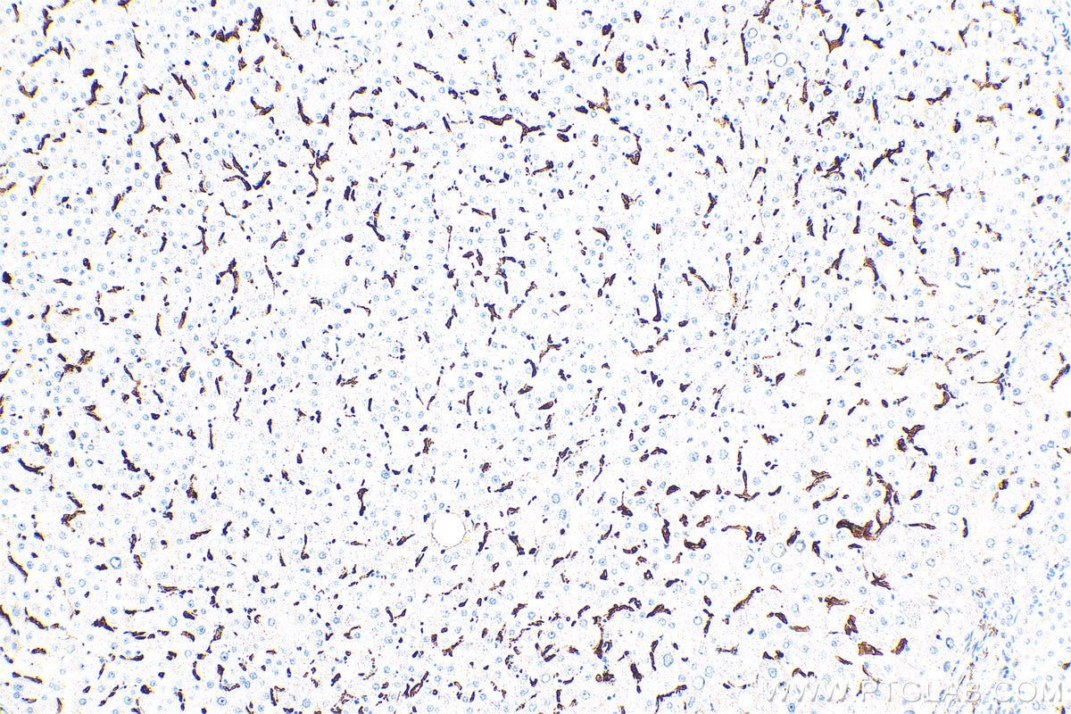 Immunohistochemistry (IHC) staining of human liver tissue using CD163 Monoclonal antibody (68218-1-Ig)