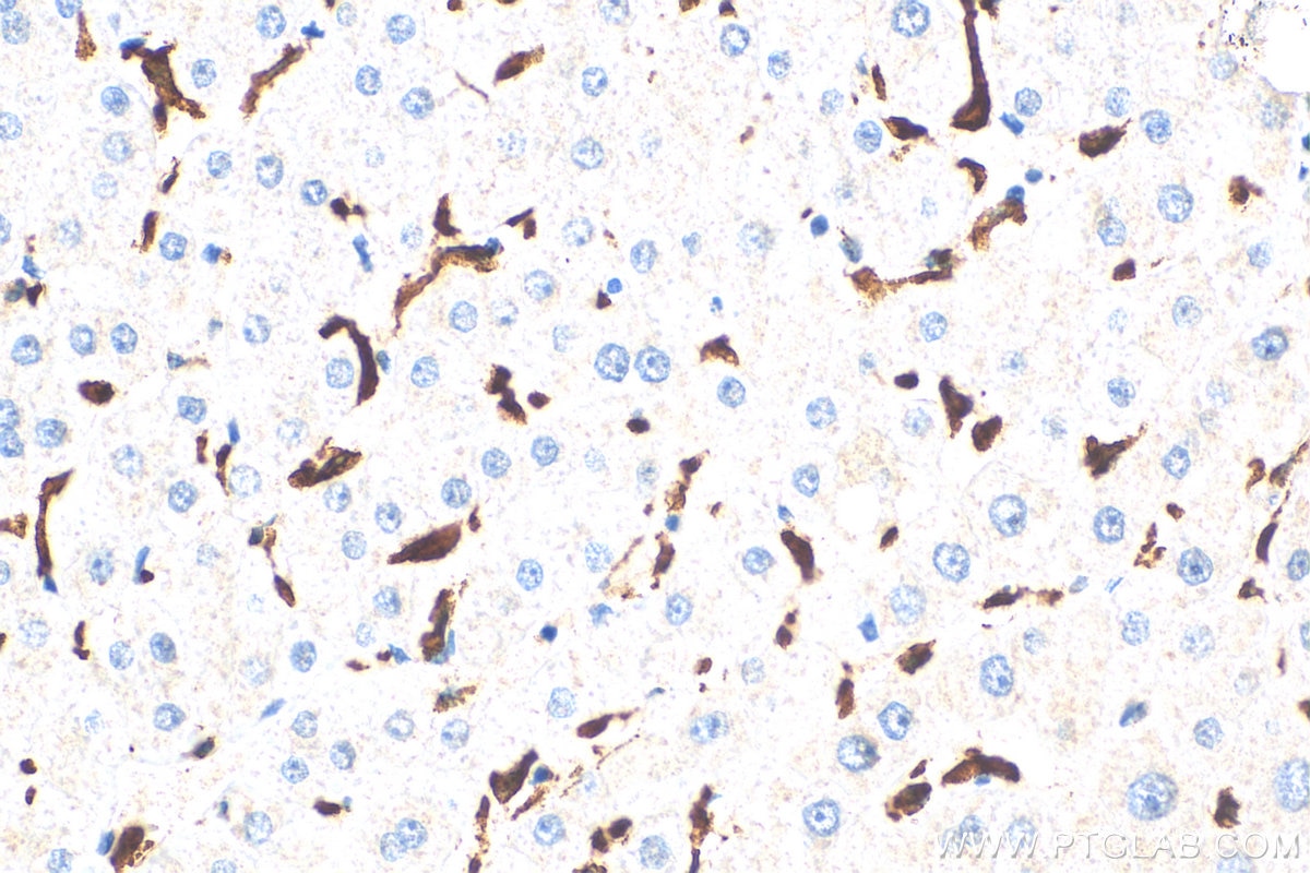 Immunohistochemistry (IHC) staining of human liver tissue using CD163 Monoclonal antibody (68218-1-Ig)