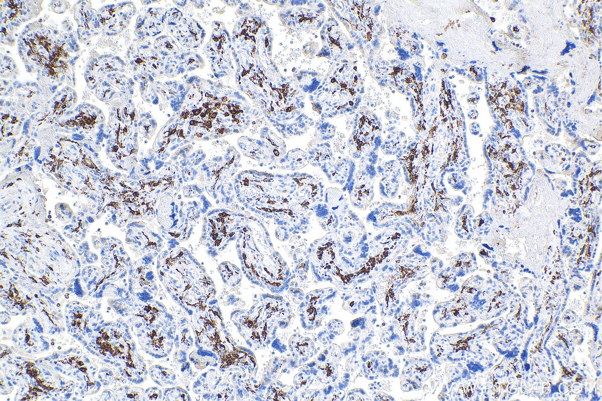 Immunohistochemistry (IHC) staining of human placenta tissue using CD163 Monoclonal antibody (68218-1-Ig)