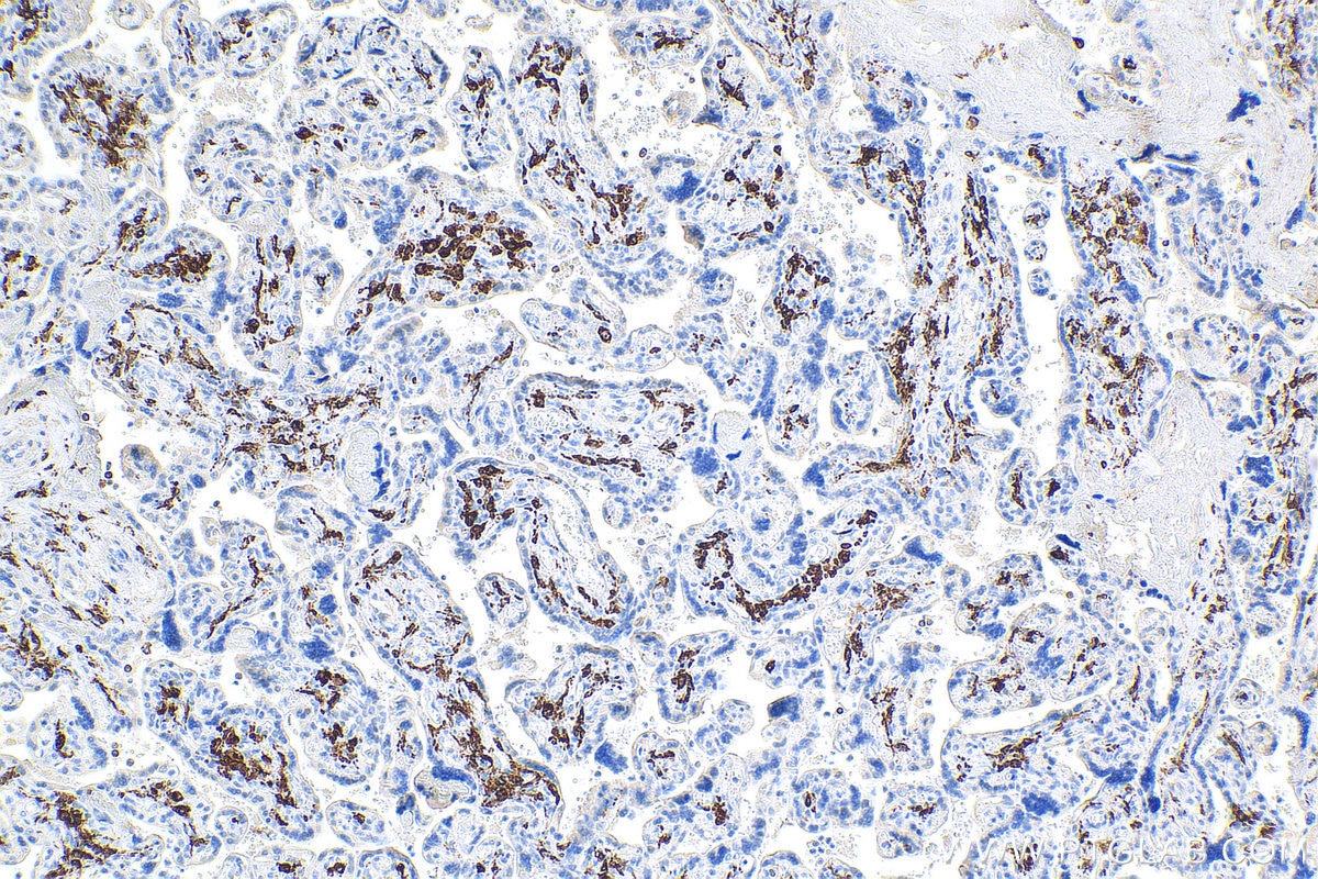 IHC staining of human placenta using 68218-1-Ig