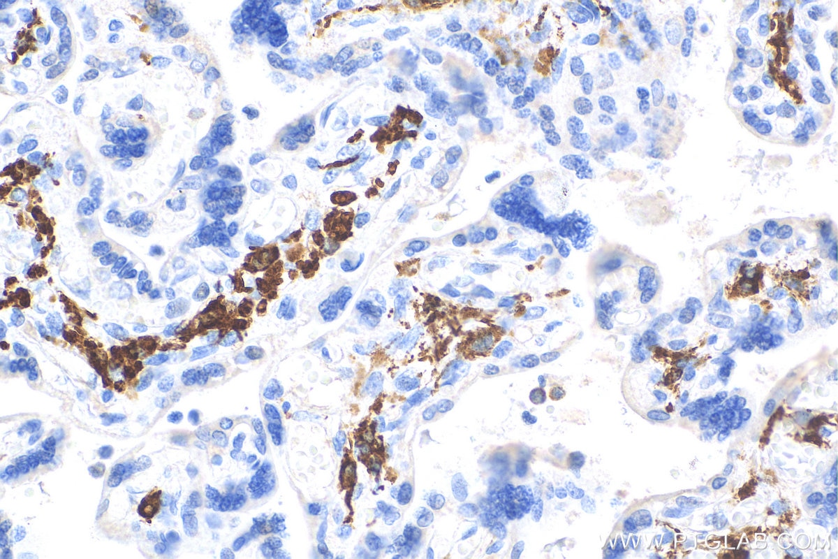 Immunohistochemistry (IHC) staining of human placenta tissue using CD163 Monoclonal antibody (68218-1-Ig)