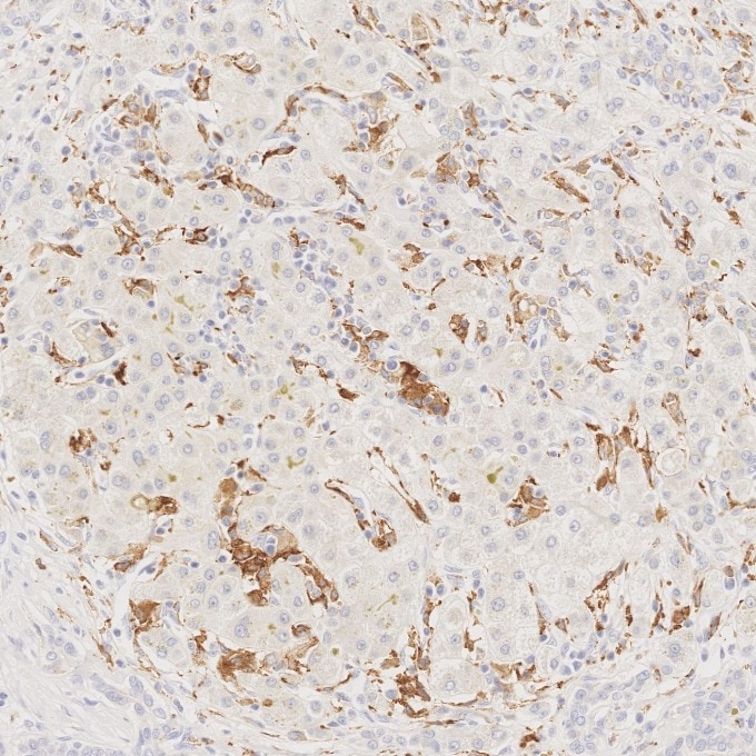 IHC staining of human liver using 68218-1-Ig Immunohistochemistry (IHC) staining of human liver tissue using CD163 Monoclonal antibody (68218-1-Ig)