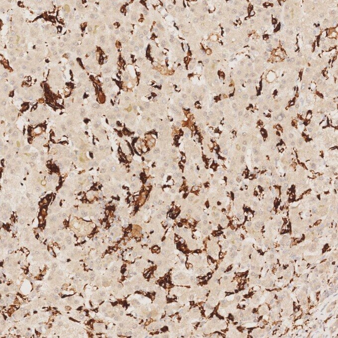 IHC staining of human liver using 68218-1-Ig Immunohistochemistry (IHC) staining of human liver tissue using CD163 Monoclonal antibody (68218-1-Ig)