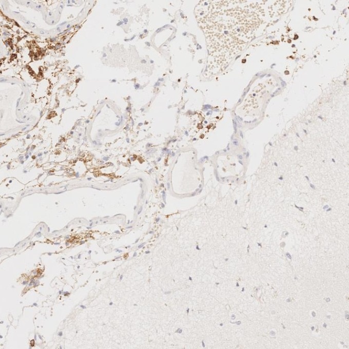 IHC staining of human brain using 68218-1-Ig Immunohistochemistry (IHC) staining of human brain tissue using CD163 Monoclonal antibody (68218-1-Ig)