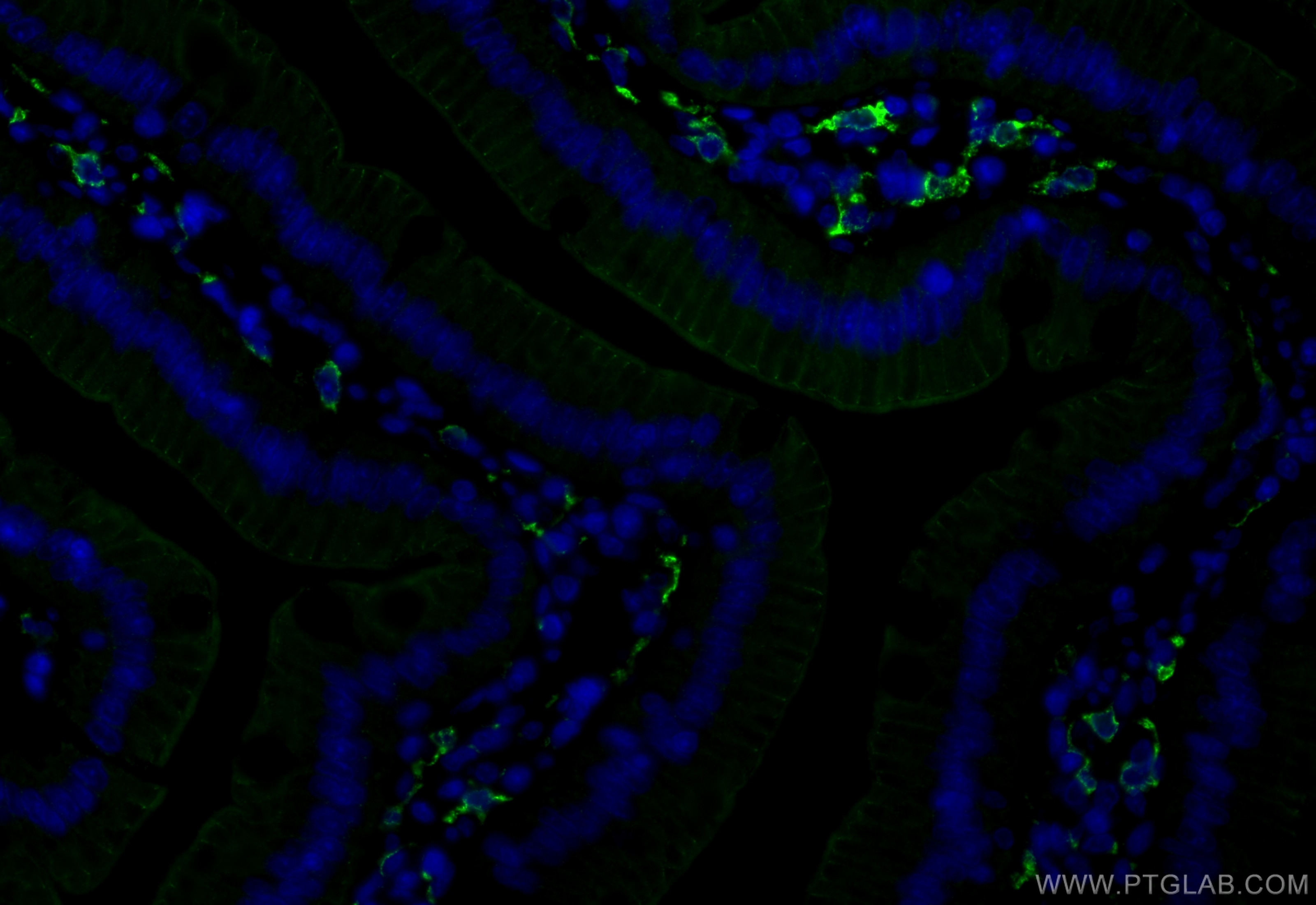 Immunofluorescence (IF) / fluorescent staining of rat small intestine tissue using CD163 Recombinant antibody (83285-4-RR)