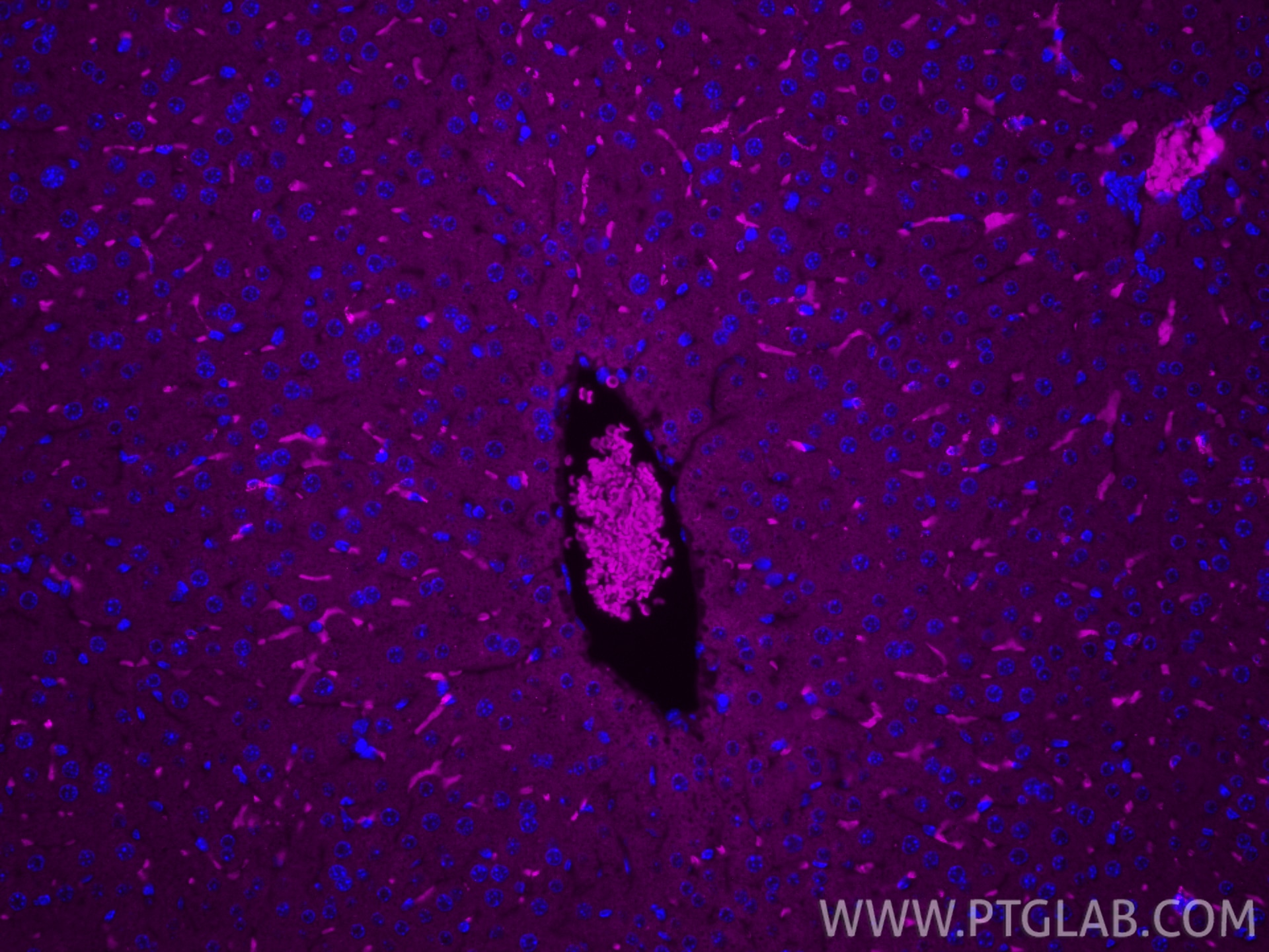 Immunofluorescence (IF) / fluorescent staining of mouse liver tissue using APC-conjugated CD163 Polyclonal antibody (APC-31024)