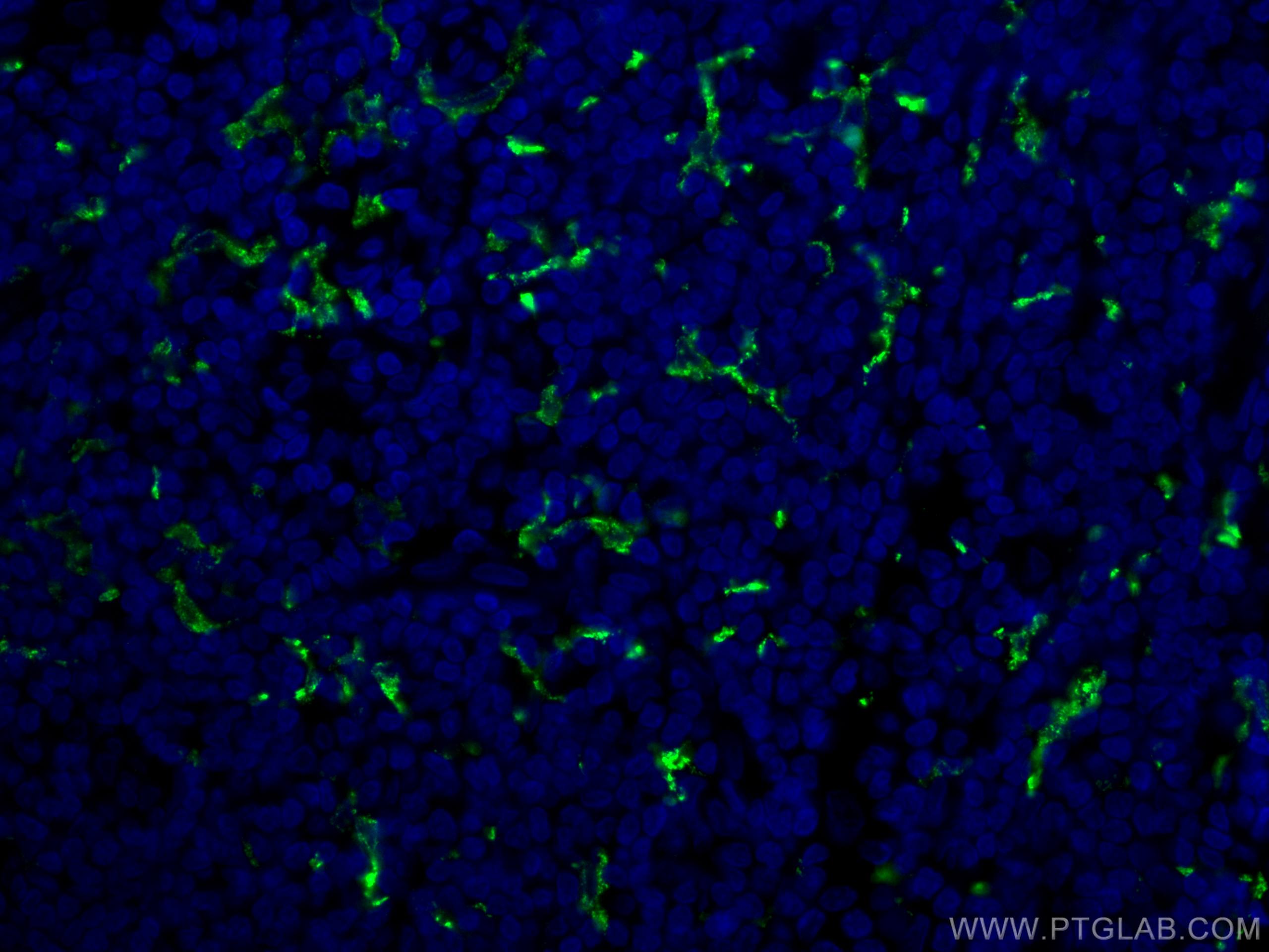 Immunofluorescence (IF) / fluorescent staining of human tonsillitis tissue using CoraLite® Plus 488-conjugated CD163 Polyclonal ant (CL488-16646)