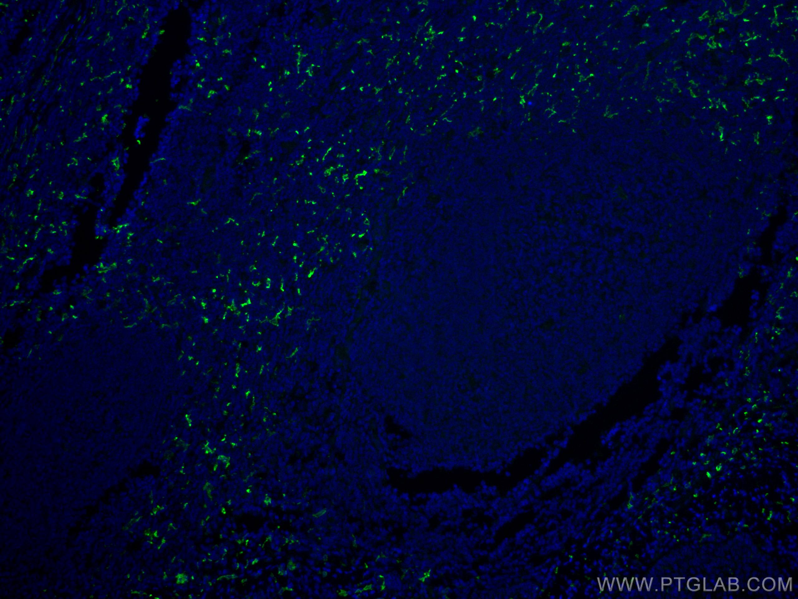 Immunofluorescence (IF) / fluorescent staining of human tonsillitis tissue using CoraLite® Plus 488-conjugated CD163 Polyclonal ant (CL488-16646)