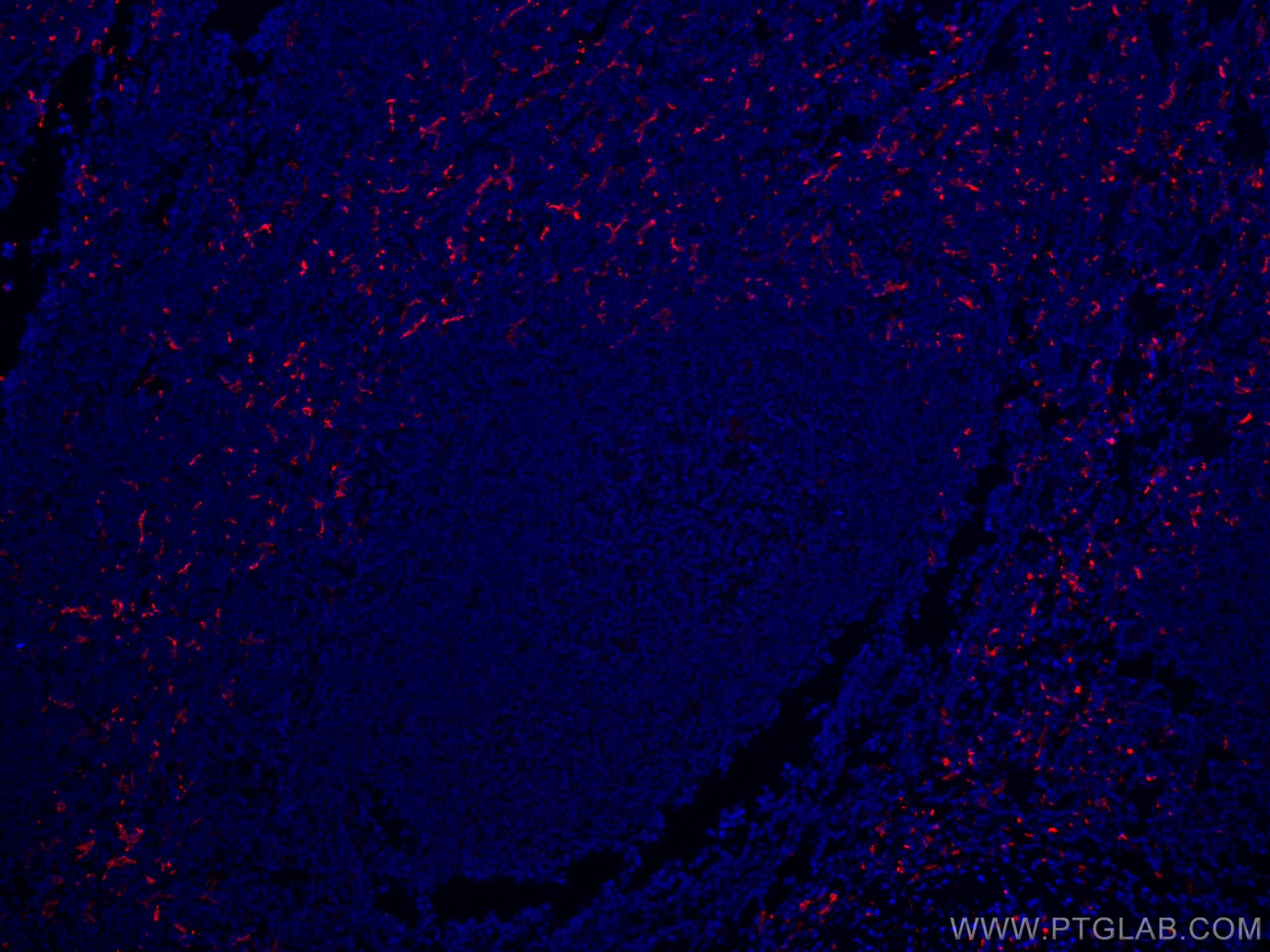 Immunofluorescence (IF) / fluorescent staining of human tonsillitis tissue using CoraLite®594-conjugated CD163 Polyclonal antibody (CL594-16646)