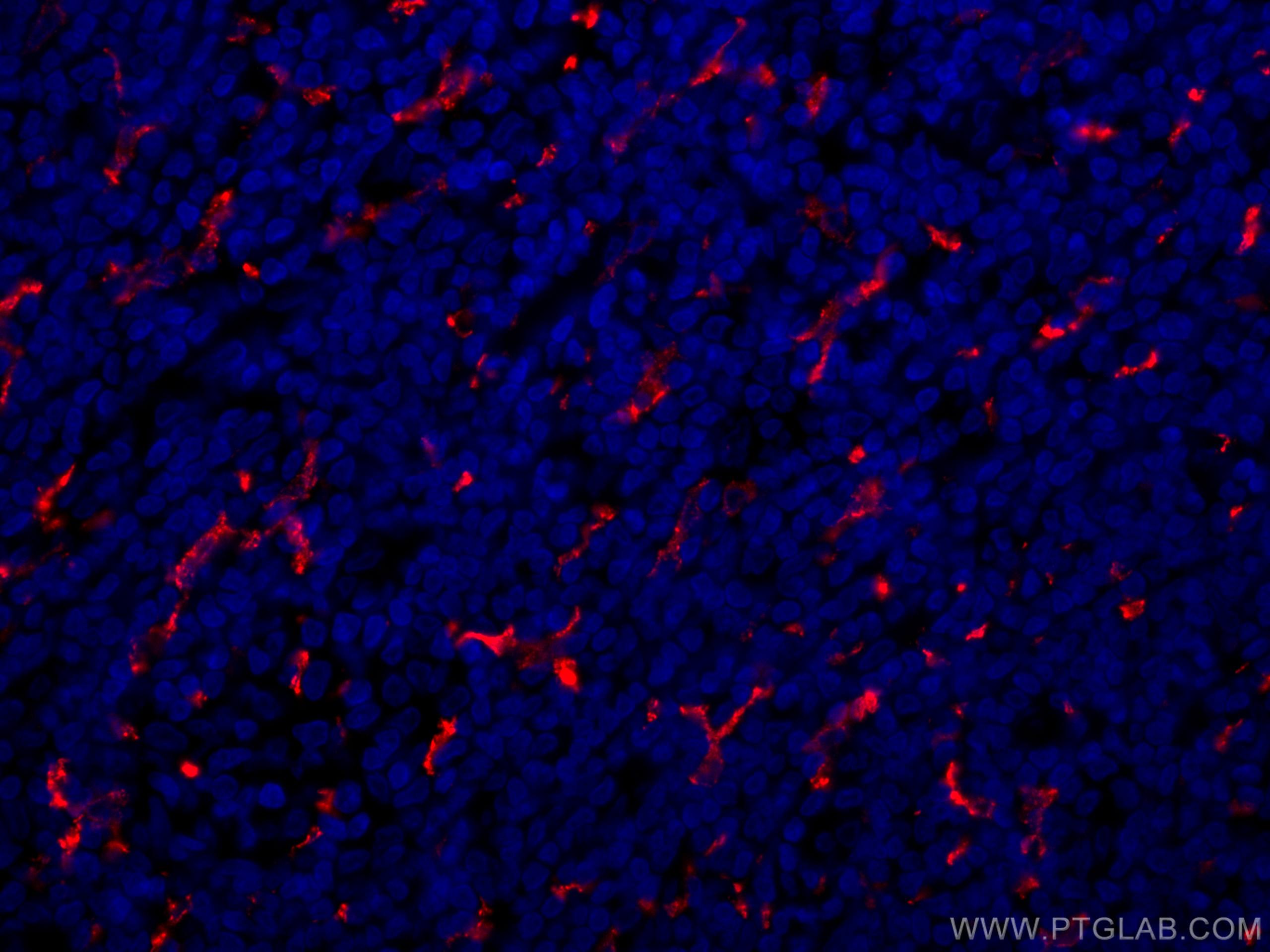 Immunofluorescence (IF) / fluorescent staining of human tonsillitis tissue using CoraLite®594-conjugated CD163 Polyclonal antibody (CL594-16646)