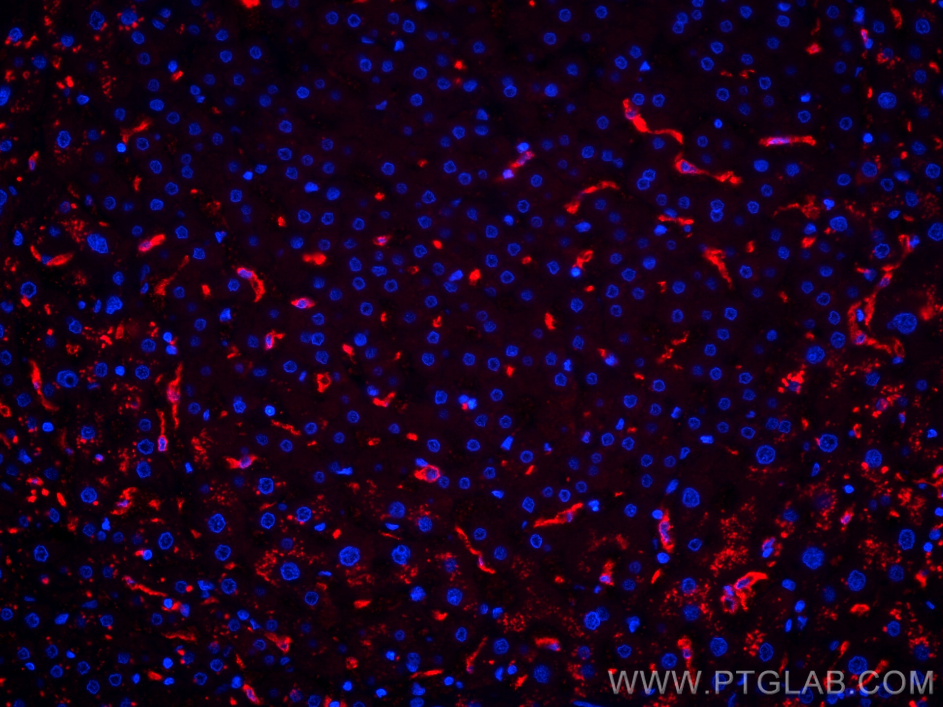 Immunofluorescence (IF) / fluorescent staining of human liver tissue using CoraLite®594-conjugated CD163 Polyclonal antibody (CL594-16646)