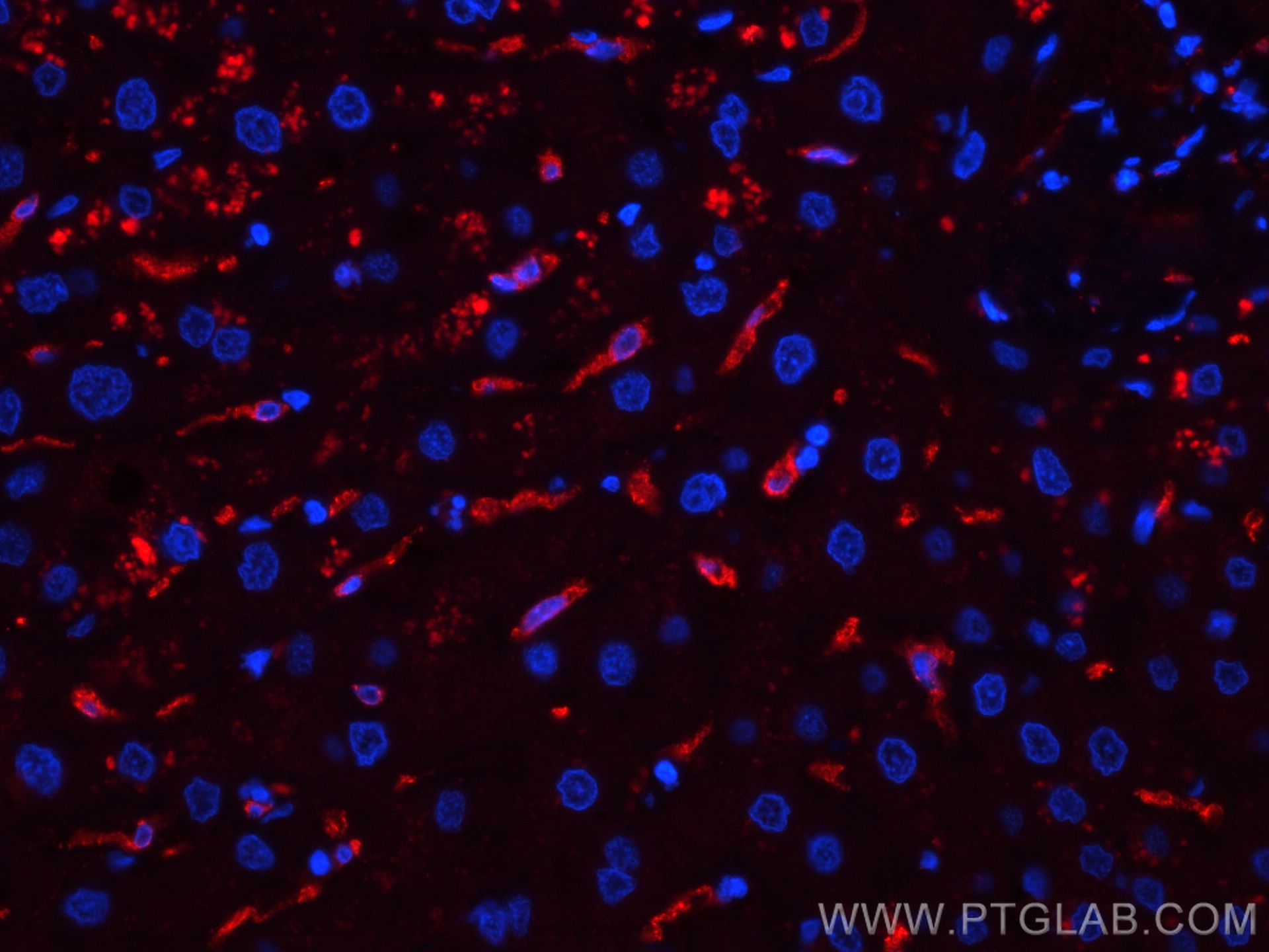 IF Staining of human liver using CL594-16646