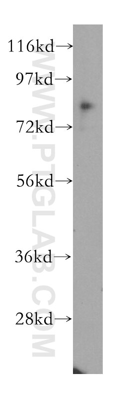 Western Blot (WB) analysis of K-562 cells using CD164 Polyclonal antibody (12083-2-AP)