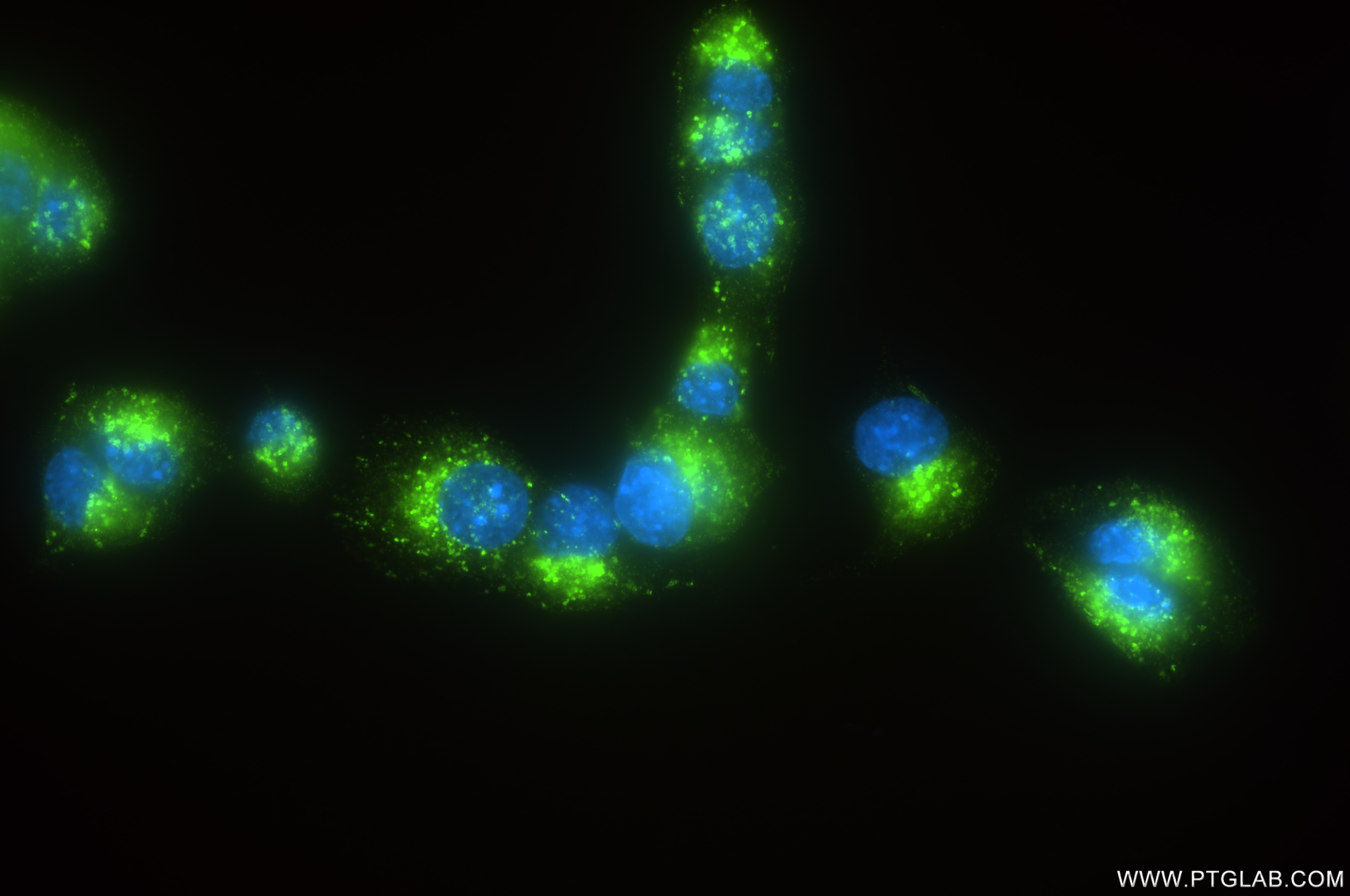 Immunofluorescence (IF) / fluorescent staining of RM-1 cells using CD164 Recombinant antibody (85723-4-RR)