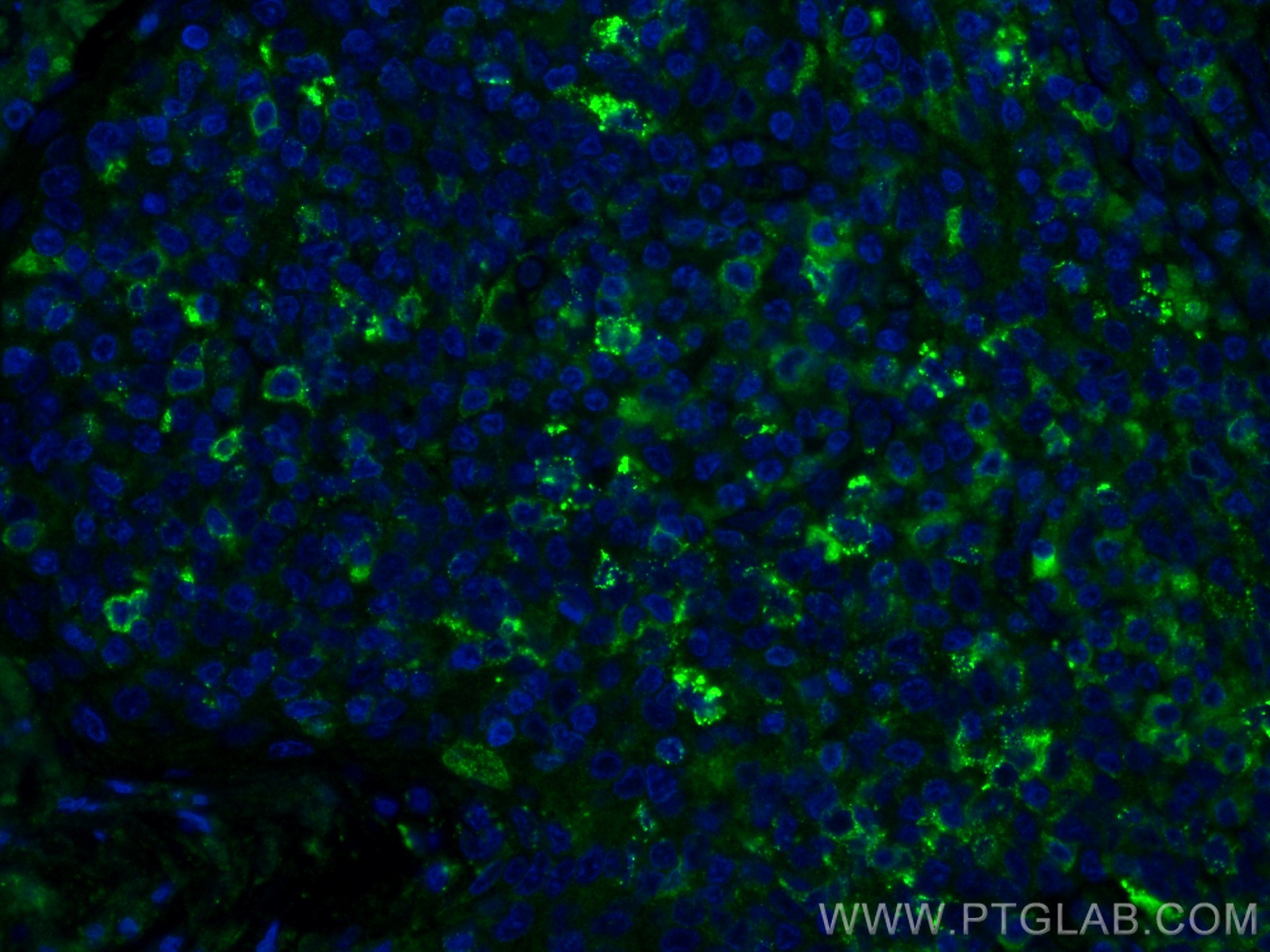Immunofluorescence (IF) / fluorescent staining of human tonsillitis tissue using CD169 Polyclonal antibody (55427-1-AP)