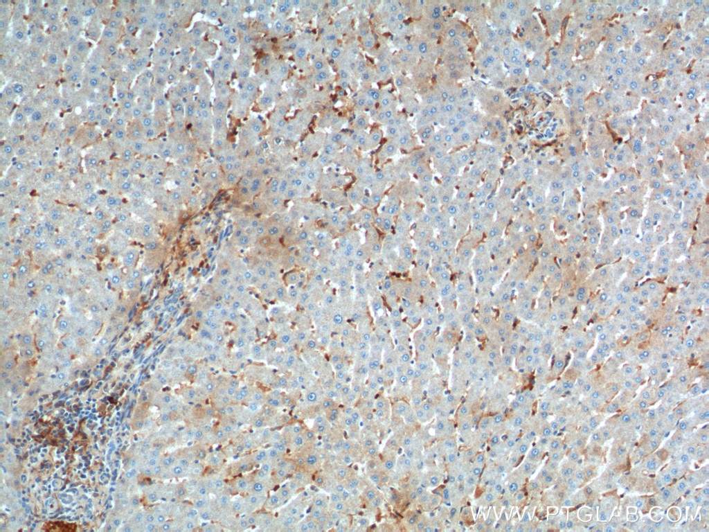Immunohistochemistry (IHC) staining of human liver tissue using CD169 Polyclonal antibody (55427-1-AP)