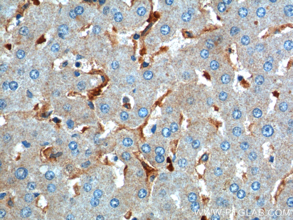 Immunohistochemistry (IHC) staining of human liver tissue using CD169 Polyclonal antibody (55427-1-AP)