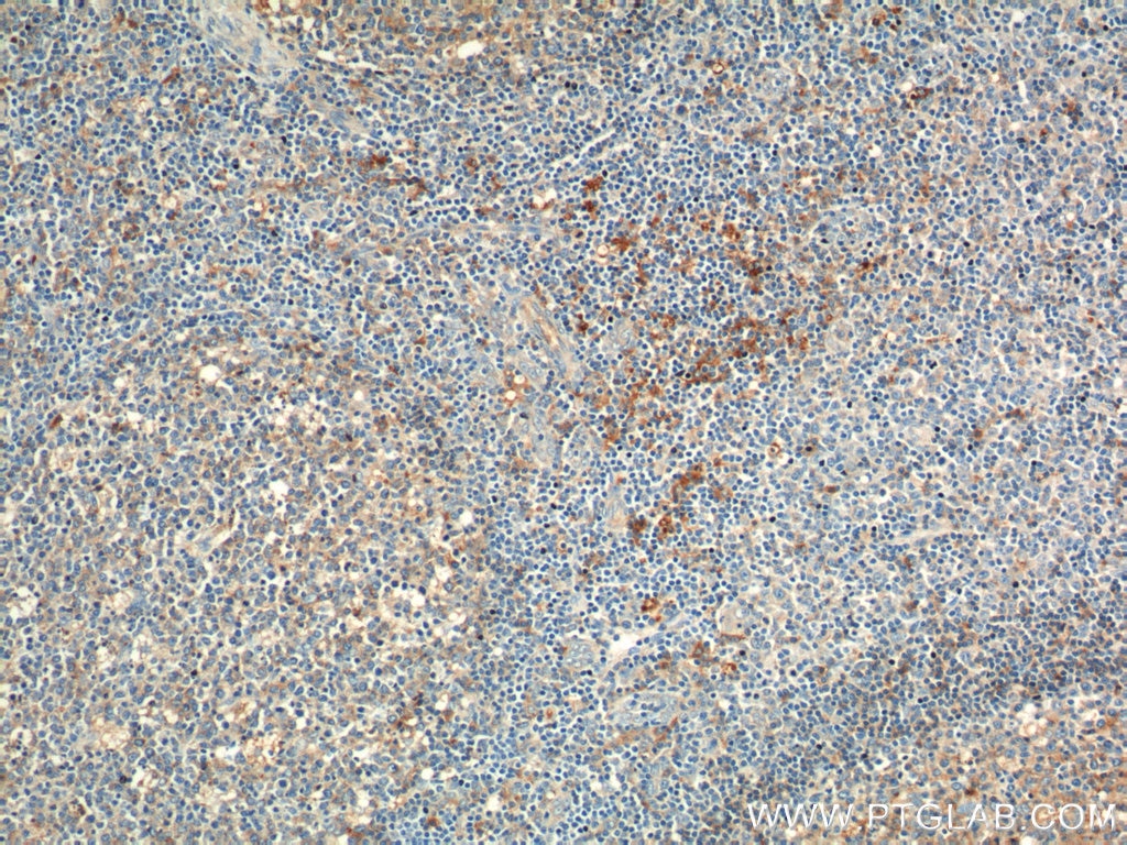 Immunohistochemistry (IHC) staining of human tonsillitis tissue using CD169 Polyclonal antibody (55427-1-AP)