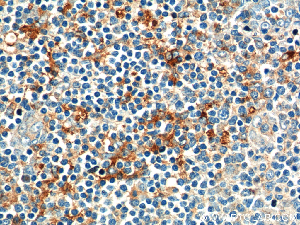 Immunohistochemistry (IHC) staining of human tonsillitis tissue using CD169 Polyclonal antibody (55427-1-AP)