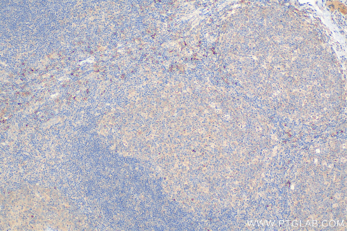 Immunohistochemistry (IHC) staining of human tonsillitis tissue using CD169 Polyclonal antibody (55427-1-AP)