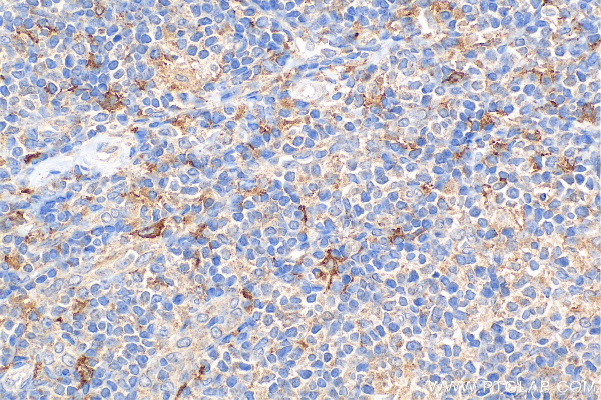 Immunohistochemistry (IHC) staining of human tonsillitis tissue using CD169 Polyclonal antibody (55427-1-AP)