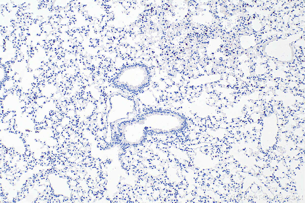 Immunohistochemistry (IHC) staining of mouse lung tissue using CD177 Polyclonal antibody (33733-1-AP)