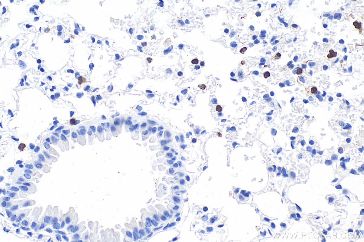 Immunohistochemistry (IHC) staining of mouse lung tissue using CD177 Polyclonal antibody (33733-1-AP)
