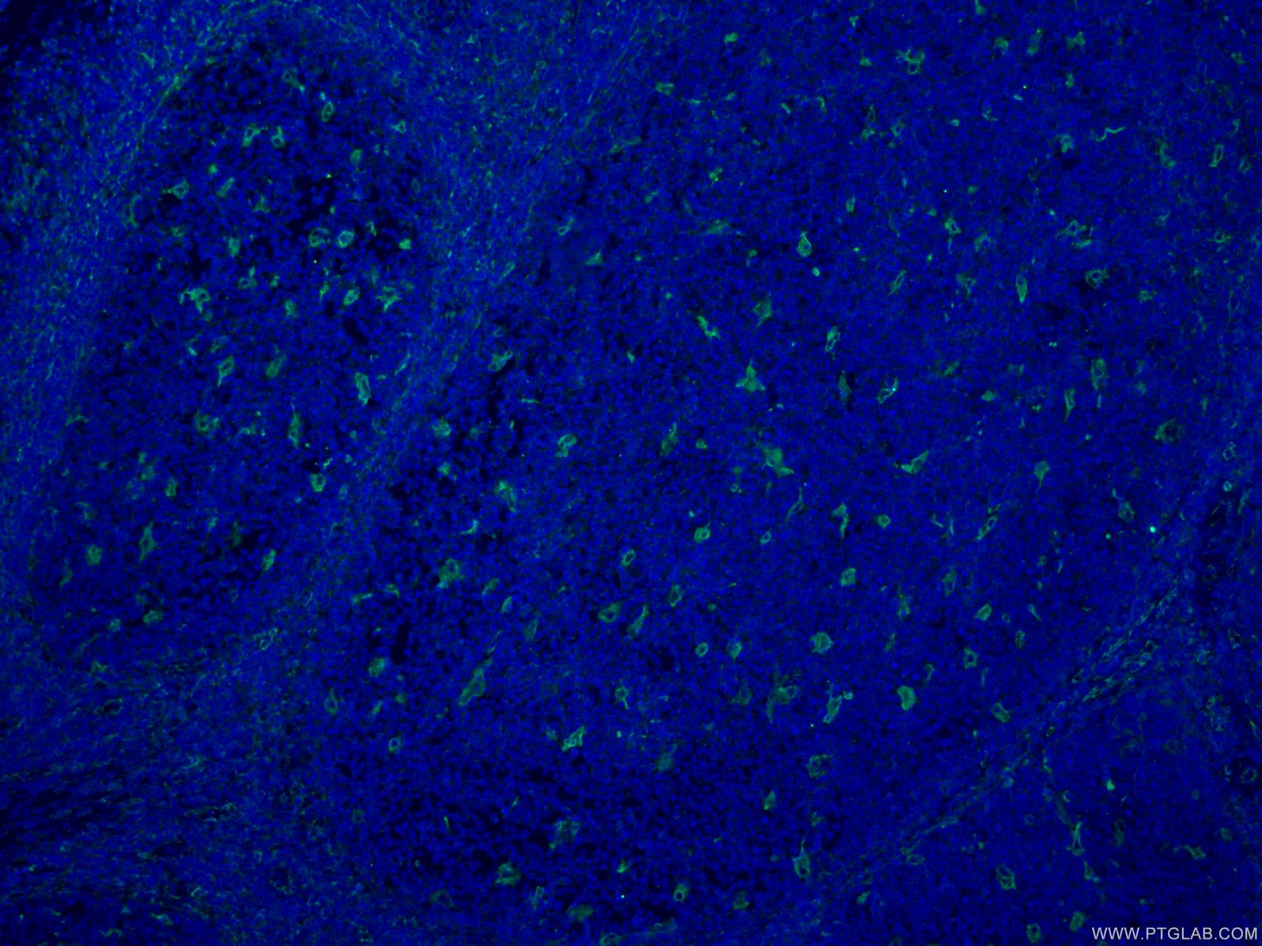 Immunofluorescence (IF) / fluorescent staining of human tonsillitis tissue using CD18 Polyclonal antibody (10554-1-AP)