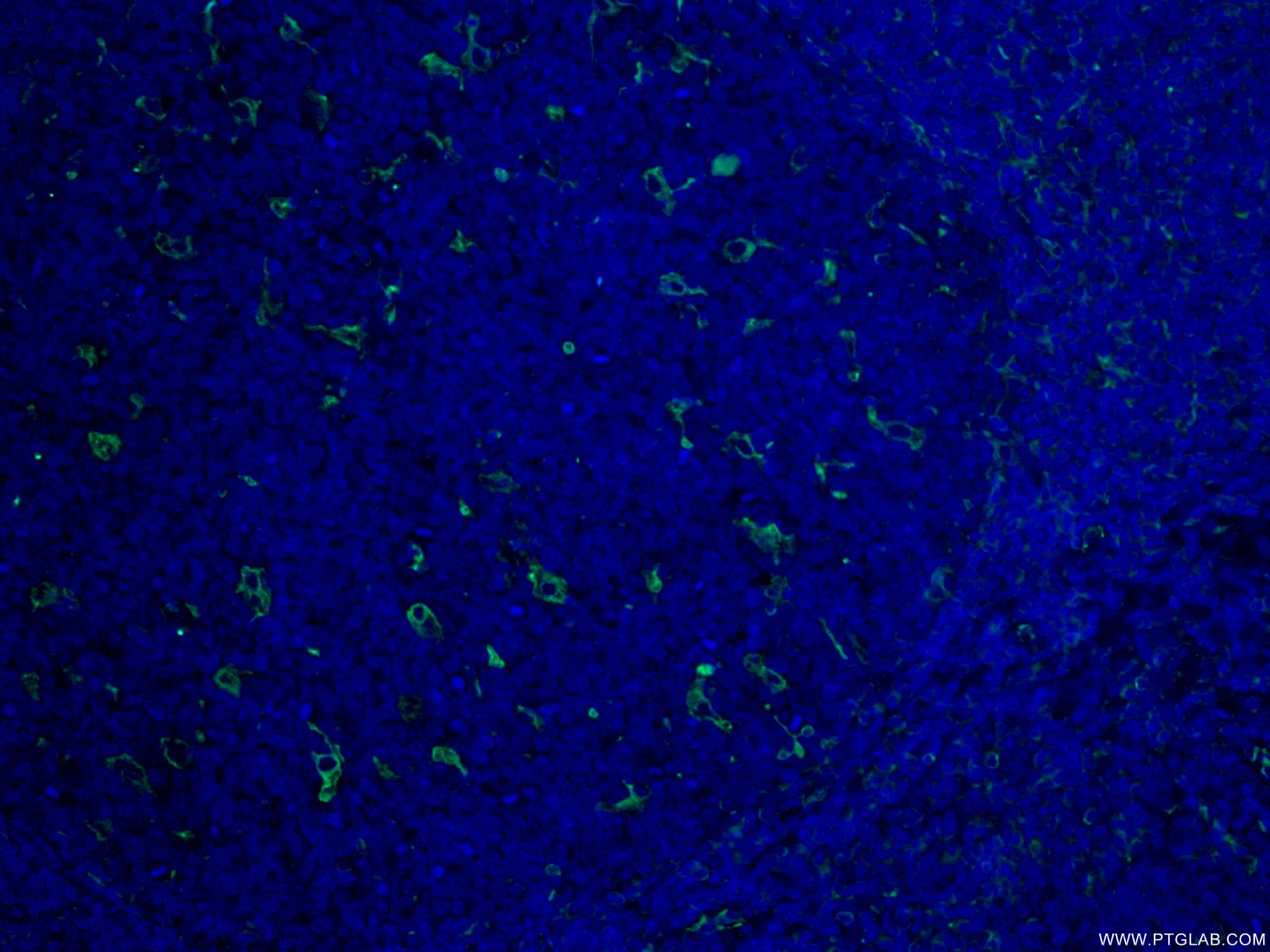 Immunofluorescence (IF) / fluorescent staining of human tonsillitis tissue using CD18 Polyclonal antibody (10554-1-AP)