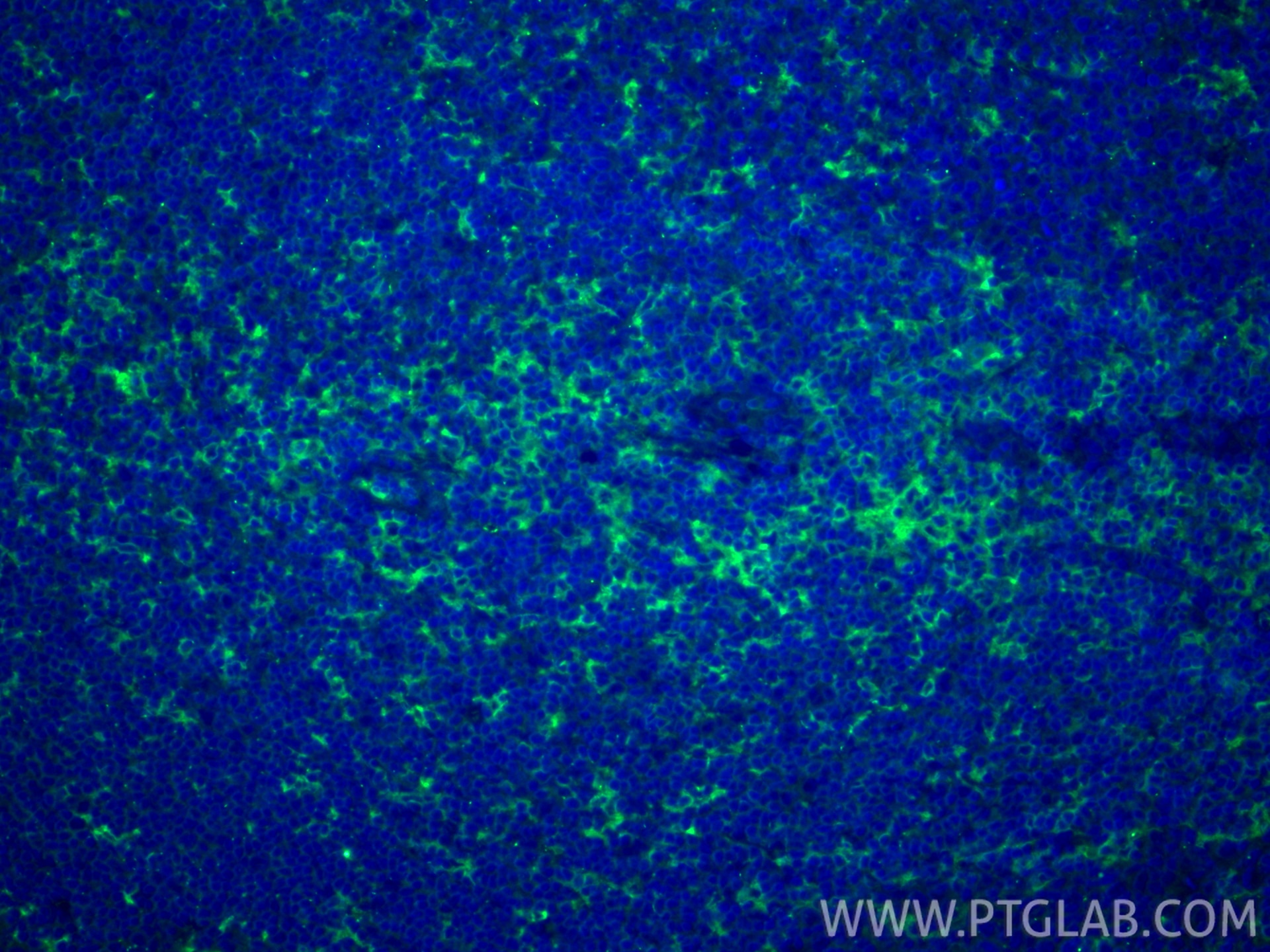 Immunofluorescence (IF) / fluorescent staining of human tonsillitis tissue using CD18 Polyclonal antibody (10554-1-AP)