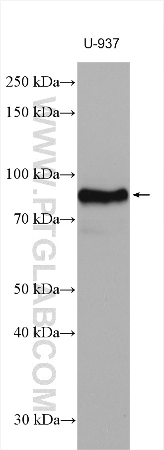 Western Blot (WB) analysis of various lysates using CD18 Polyclonal antibody (10554-1-AP)