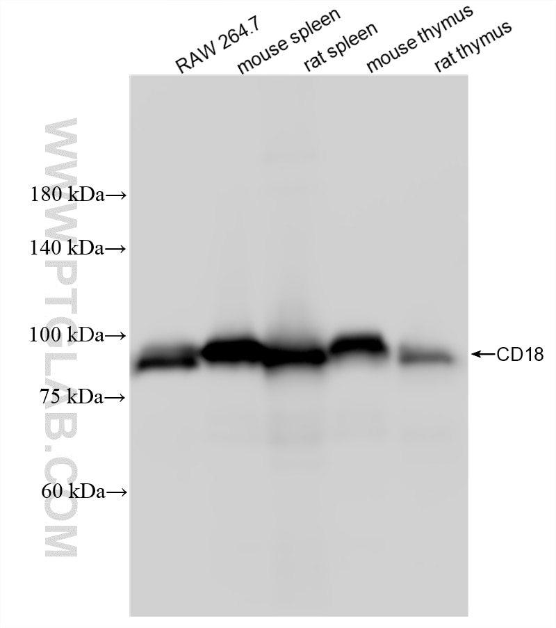 Western Blot (WB) analysis of various lysates using CD18 Recombinant monoclonal antibody (87481-1-RR)