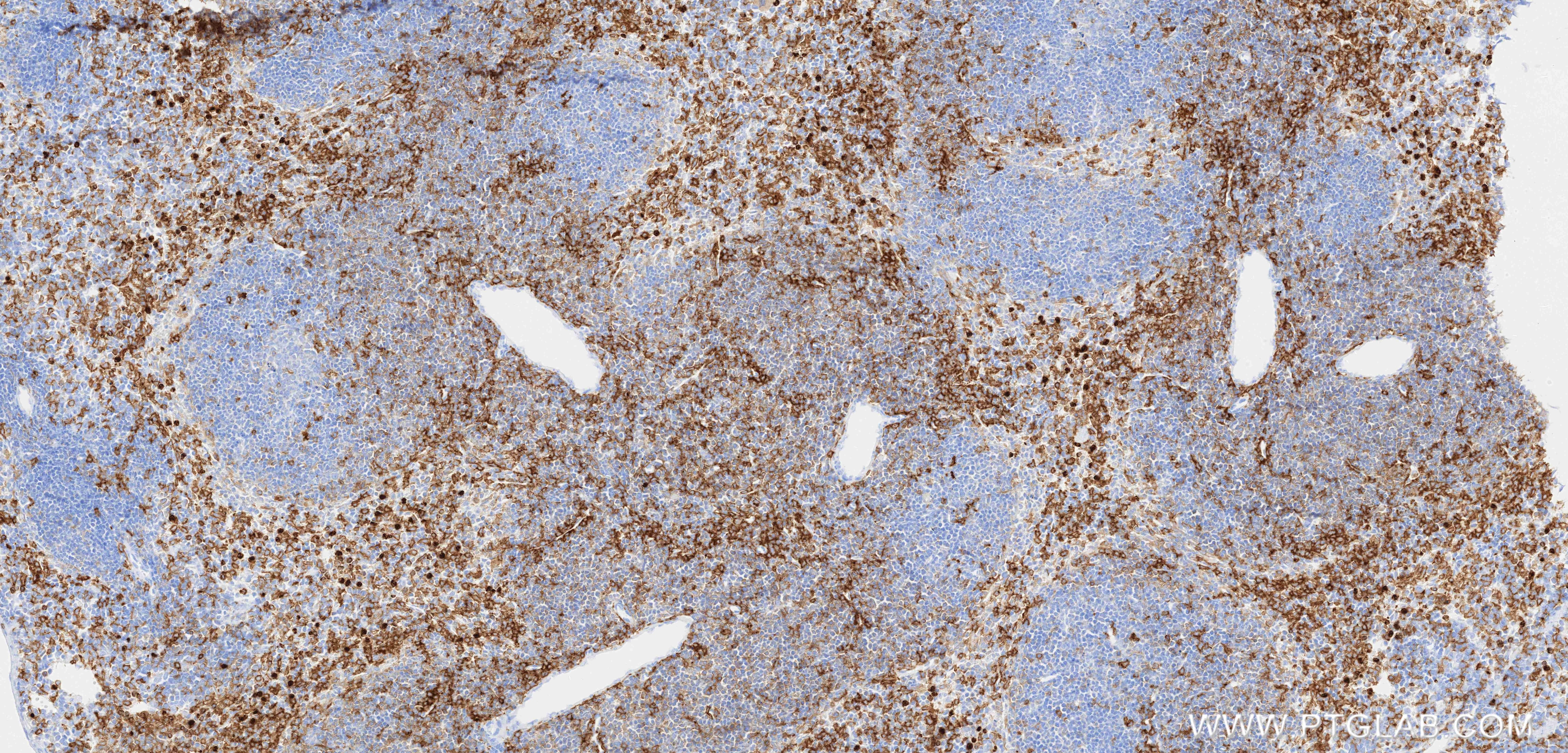 IHC staining of mouse spleen using 87481-2-RR (same clone as 87481-2-PBS) Immunohistochemistry (IHC) staining of mouse spleen tissue using CD18 Recombinant monoclonal antibody (87481-2-RR)