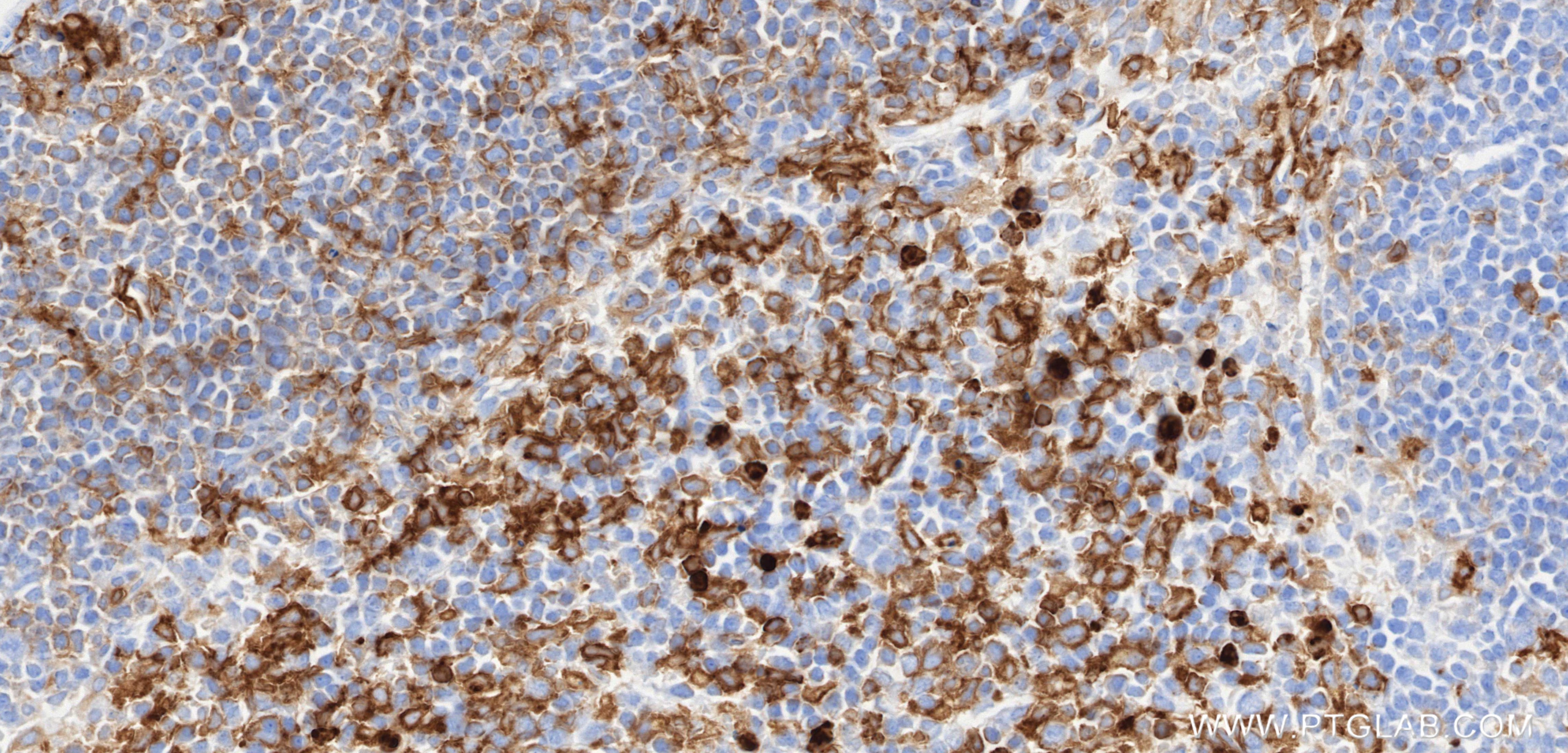 IHC staining of mouse spleen using 87481-2-RR (same clone as 87481-2-PBS) Immunohistochemistry (IHC) staining of mouse spleen tissue using CD18 Recombinant monoclonal antibody (87481-2-RR)