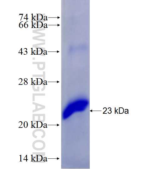 CD18 fusion protein Ag27695 SDS-PAGE