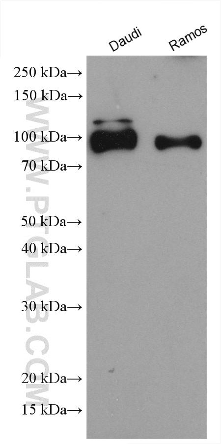 Western Blot (WB) analysis of various lysates using CD180 Polyclonal antibody (28304-1-AP)