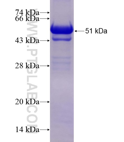 CD180 fusion protein Ag28476 SDS-PAGE