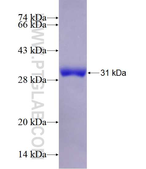 CD180 fusion protein Ag28488 SDS-PAGE